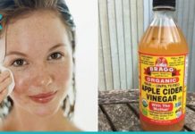 ვაშლის ძმრის 6 საუკეთესო რეცეპტი სახის კანისთვის!