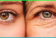 მოამზადეთ თვალის ნატურალური კრემი, რომელიც გაგიქრობთ წვრილ ნაოჭებს