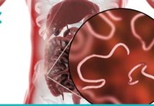 განთავისუფლდით პარაზიტებისგან ერთ თვეში ამ მარტივი და ეფექტური საშუალებით