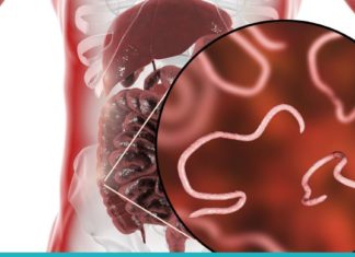 განთავისუფლდით პარაზიტებისგან ერთ თვეში ამ მარტივი და ეფექტური საშუალებით