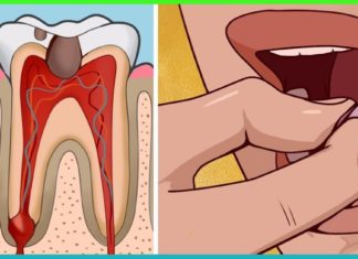 თქვენ ნამდვილად შეგიძლიათ თავი დააღწიოთ კბილის აუტანელ ტკივილს სახლის პირობებში