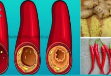 ბუნებრივი სისხლის გამათხელებელი თრომბის თავიდან ასაცილებლად