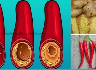 ბუნებრივი სისხლის გამათხელებელი თრომბის თავიდან ასაცილებლად