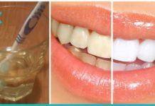 ნატურალური მეთოდები კბილის მინანქართან საბრძოლველად სახლის პირობებში!