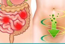 სახლის პირობებში მსხვილი ნაწლავის გასუფთავება