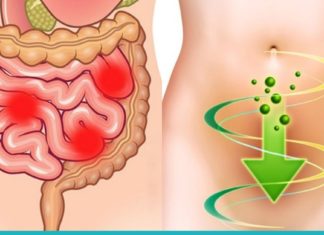 სახლის პირობებში მსხვილი ნაწლავის გასუფთავება