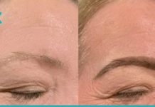 იდეალური ბუნებრივი საშუალება წარბების გასასქელებლად