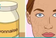 9 ბუნებრივი საშუალება მშრალი კანის დასატენიანებლად