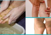 შეიზილეთ ეს ნარევი ფეხებზე და დაემშვიდობეთ ვარიკოზულ ვენებს, მაზოლებსა და დამსკდარ ქუსლებს სულ რაღაც 10 დღეში