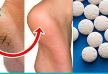 გამოიყენეთ ასპირინი დამსკდარი ქუსლების სამკურნალოდ