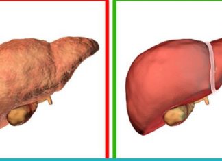 გაისუფთავეთ ღვიძლი სახლის პირობებში ამ სასმელების დახმარებით
