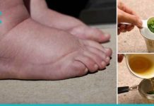 დაემშვიდობეთ სითხის შეკავებას, შეშუპებასა და ჭარბ წონას ერთ კვირაში ამ რეცეპტის დახმარებით!