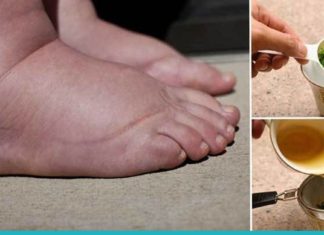 დაემშვიდობეთ სითხის შეკავებას, შეშუპებასა და ჭარბ წონას ერთ კვირაში ამ რეცეპტის დახმარებით!