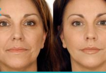 ეს ნიღბები ფაქტიურად აქრობენ ნაოჭებს