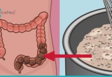 გამოიყენეთ სელის თესლის ორგანიზმიდან მავნე ნივთიერებების გამოსადევნად