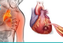 ეს პროდუქტები გაწმენდს არტერიებს და დაგიცავთ გულის შეტევისგან! რაც ხშირად შეჭამთ მათ, უფრო დიდხანს იცოცხლებთ!