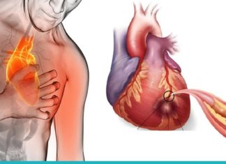 ეს პროდუქტები გაწმენდს არტერიებს და დაგიცავთ გულის შეტევისგან! რაც ხშირად შეჭამთ მათ, უფრო დიდხანს იცოცხლებთ!