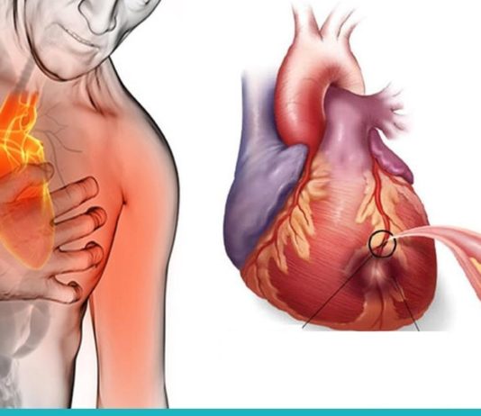 ეს პროდუქტები გაწმენდს არტერიებს და დაგიცავთ გულის შეტევისგან! რაც ხშირად შეჭამთ მათ, უფრო დიდხანს იცოცხლებთ!