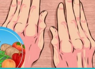 მიიღეთ საუზმეზე ეს 5 პროდუქტი და დაემშვიდობეთ ართრიტს სამუდამოდ