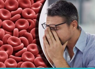 ანემიის 6 გამაფრთხილებელი ნიშანი