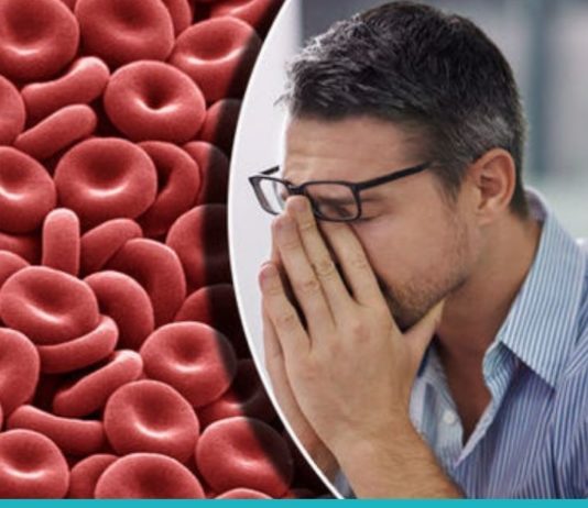 ანემიის 6 გამაფრთხილებელი ნიშანი