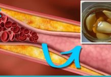 5 რეცეპტი ქოლესტერინისა და მაღალი წნევის დასარეგულირებლად