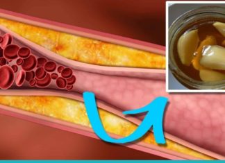 5 რეცეპტი ქოლესტერინისა და მაღალი წნევის დასარეგულირებლად