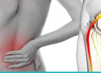 უმკურნალეთ საჯდომის ნერვს ამ რეცეპტების საშუალებით