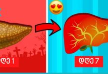 თქვენ შეგიძლიათ აღადგინოთ ღვიძლი და გაწმინდოთ ის ცხიმებისგან 5-7 დღეში ამ ბუნებრივი საშუალებებით