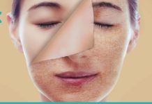 Მშრალი კანის დატენიანება საუკეთესო საშინაო მეთოდებით