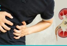 მოიშორეთ თირკმელებიდან კენჭები ამ სიროფის დახმარებით