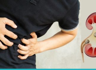 მოიშორეთ თირკმელებიდან კენჭები ამ სიროფის დახმარებით