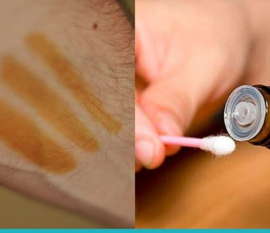 იცით რა მოხდება, თუ მაჯებზე იოდს წაისვამთ? ეს ყველამ უნდა იცოდეს!