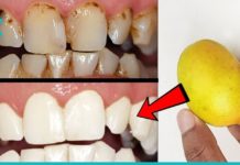 4 რეცეპტი ლიმონით პირის ღრუს მოსავლელად