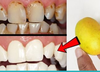 4 რეცეპტი ლიმონით პირის ღრუს მოსავლელად