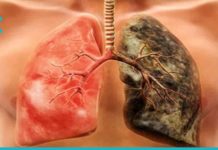 8 პროდუქტი, რომელიც კლავს ნიკოტინს