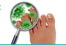 3 ეფექტური საშუალება ფრჩხილის სოკოს მოსაშორებლად!