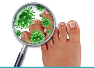 3 ეფექტური საშუალება ფრჩხილის სოკოს მოსაშორებლად!