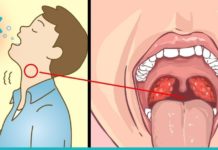 მარილის გამოყენების ჯანსაღი და სასარგებლო გზები