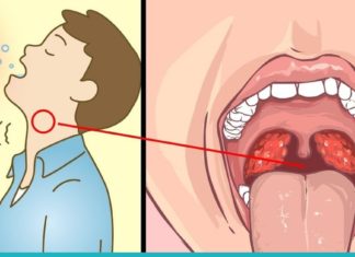 მარილის გამოყენების ჯანსაღი და სასარგებლო გზები