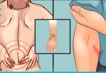 თირკმლების დაზიანების მაფრთხილებელი ნიშნები. აუცილებლად მიაქციეთ ყურადღება