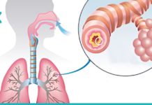 ასთმის და ბრონქიტის მკურნალობის საუკეთესო გზა. ეს რეცეფტი პრობლემას სამუდამოდ დაგავიწყებთ