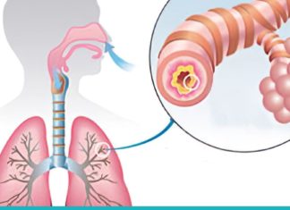 ასთმის და ბრონქიტის მკურნალობის საუკეთესო გზა. ეს რეცეფტი პრობლემას სამუდამოდ დაგავიწყებთ