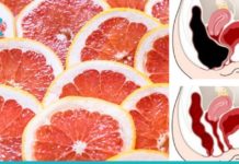 გაწუხებთ სახსრების ტკივილი, თირკმელები და გულის დაავადებები? მაშინ სახლში ბევრი გრეიფრუტი მოიმარაგეთ