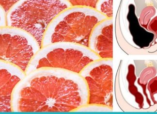 გაწუხებთ სახსრების ტკივილი, თირკმელები და გულის დაავადებები? მაშინ სახლში ბევრი გრეიფრუტი მოიმარაგეთ