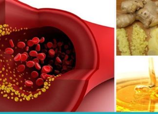 ეს 8 პროდუქტი ათხელებს სისხლს და ახდენს თრომბოზის პროფილაქტიკას.