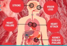 მაღალი წნევა და გულის პრობლემები გაწუხებთ? მაშინ სასწრაფოდ უარი თქვით ამ პროდუქტებზე