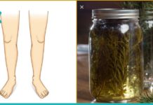 როზმარინის სპირტი- დაემშვიდობეთ ვარიკოზულ ვენებს, პოდაგრას, კუნთების ტკივილსა და ცელულიტს.