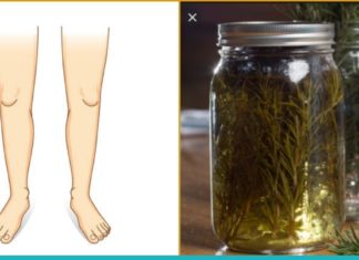 როზმარინის სპირტი- დაემშვიდობეთ ვარიკოზულ ვენებს, პოდაგრას, კუნთების ტკივილსა და ცელულიტს.