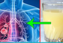 გამოდევნეთ ნიკოტინი სხეულიდან ამ 6 საშუალების დახმარებით